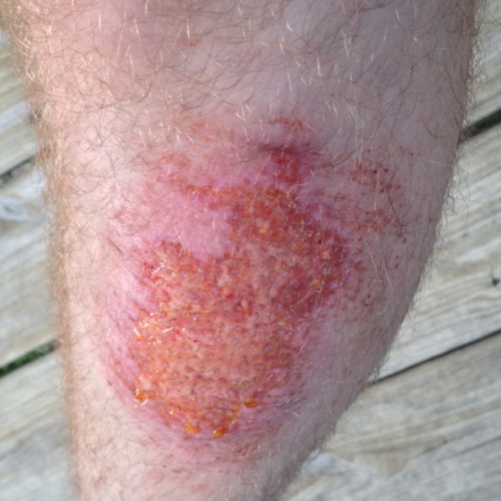 influenstermyfirstvoxbox